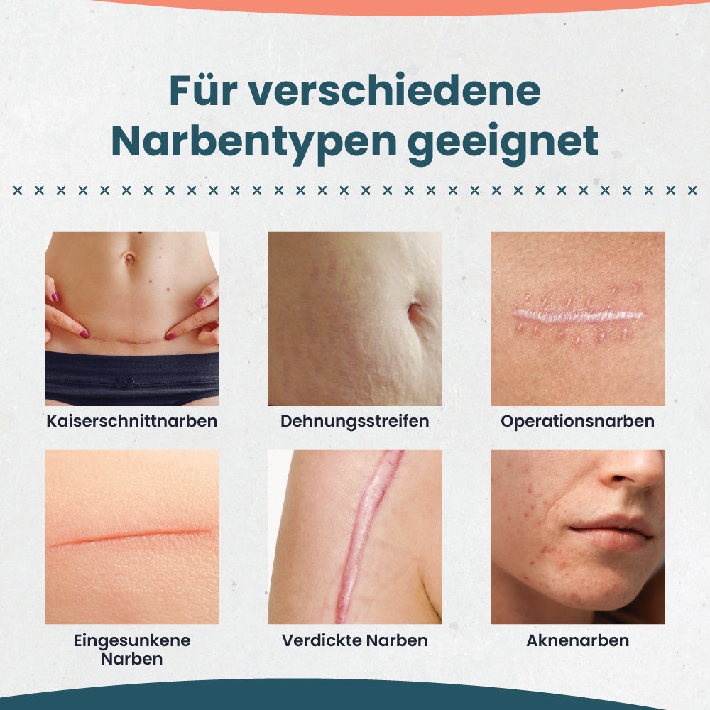 TAMPEN Narbenpflaster 3,5 × 200 cm
