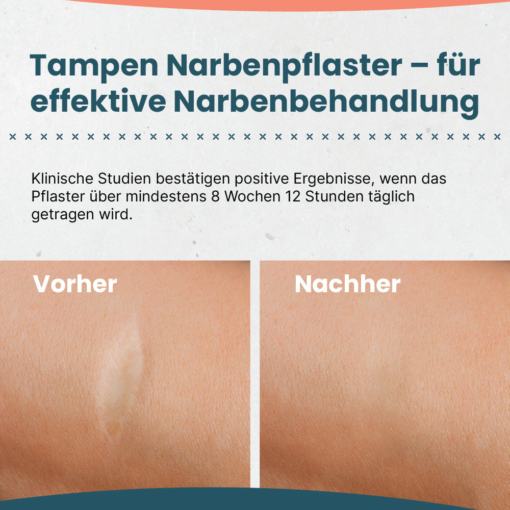 TAMPEN Narbenpflaster 3,5 × 200 cm